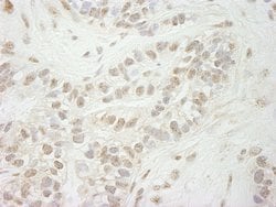 JARID1B Polyclonal Antibody, Bethyl Laboratories:Antibodies:Primary Antibodies