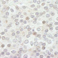 JARID1B Polyclonal Antibody, Bethyl Laboratories 10 &mu;L; Unconjugated:Antibodies,