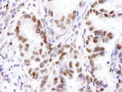 JHDM1A Rabbit anti-Human, Polyclonal, Bethyl Laboratories 100 &mu;L; Unconjugated:Antibodies,