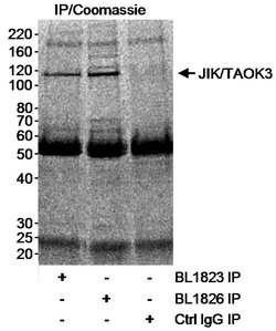 JIK/TAOK3 Rabbit anti-Human, Polyclonal, Bethyl Laboratories 100 &mu;L;