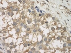 JLP Rabbit anti-Human, Mouse, Polyclonal, Bethyl Laboratories 100 &mu;L;