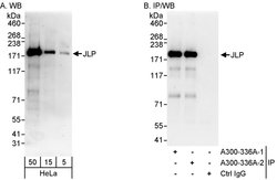 JLP Rabbit anti-Human, Mouse, Rat, Polyclonal, Bethyl Laboratories 100