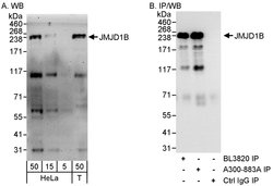 JMJD1B Rabbit anti-Human, Polyclonal, Bethyl Laboratories 100 &mu;L; Unconjugated:Antibodies,