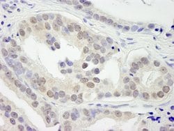 JMJD1B Polyclonal Antibody, Bethyl Laboratories 10 &mu;L; Unconjugated:Antibodies,