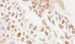JMJD1C Rabbit anti-Human, Polyclonal, Bethyl Laboratories 100 &mu;L; Unconjugated:Antibodies,