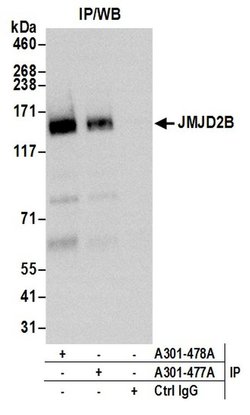 JMJD2B Rabbit anti-Human, Polyclonal, Bethyl Laboratories 10 &mu;L; Unconjugated:Antibodies,
