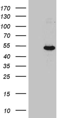 JMJD5 Monoclonal Antibody (OTI5D11), TrueMAB , OriGene 100 &mu;L; Unconjugated:Antibodies,