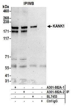 KANK1 Rabbit anti-Human, Polyclonal, Bethyl Laboratories 100 &mu;L; Unconjugated:Antibodies,