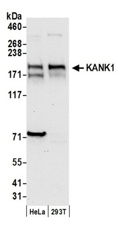 KANK1 Polyclonal Antibody, Bethyl Laboratories 20 &mu;L; Unconjugated:Antibodies,