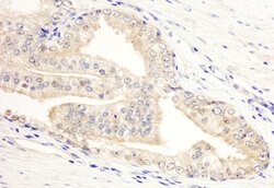 KANK2/SIP Rabbit anti-Human, Polyclonal, Bethyl Laboratories 100 &mu;L;