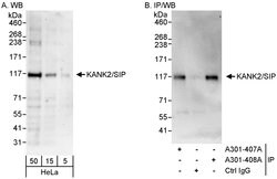 KANK2/SIP Rabbit anti-Human, Polyclonal, Bethyl Laboratories 100 &mu;L;