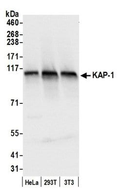 KAP-1 Polyclonal Antibody, Bethyl Laboratories 20 μL; Unconjugated:Antibodies,