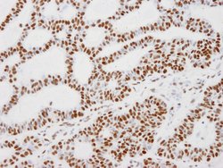 KAP-1 Polyclonal Antibody, Bethyl Laboratories 100 &mu;l; Unlabeled:Antibodies,