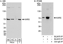 KARS Rabbit anti-Human, Polyclonal, Bethyl Laboratories 100 &mu;L; Unconjugated:Antibodies,