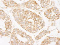 KARS Polyclonal Antibody, Bethyl Laboratories 100 &mu;L | Buy Online | Bethyl Laboratories, Inc | Fisher Scientific