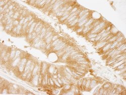 KARS Polyclonal Antibody, Bethyl Laboratories 100 &mu;L | Buy Online | Bethyl Laboratories, Inc | Fisher Scientific