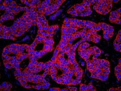 KARS Polyclonal Antibody, Bethyl Laboratories 100 &mu;L | Buy Online | Bethyl Laboratories, Inc | Fisher Scientific