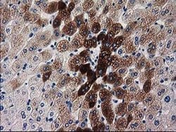 KATNAL1 Monoclonal Antibody (OTI1A7), TrueMAB , OriGene 100 &mu;L; Unconjugated:Antibodies,