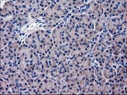 KATNAL1 Monoclonal Antibody (OTI6A4), TrueMAB , OriGene 100 &mu;L; Unconjugated:Antibodies,