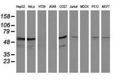 KATNAL1 Monoclonal Antibody (OTI1A7), TrueMAB , OriGene:Antibodies:Primary