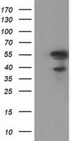 KATNAL1 Monoclonal Antibody (OTI6A4), TrueMAB , OriGene 100 &mu;L; Unconjugated:Antibodies,