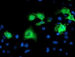 KATNB1 Monoclonal Antibody (OTI5A1), TrueMAB , OriGene:Antibodies:Primary