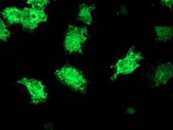 KATNB1 Monoclonal Antibody (OTI3B6), TrueMAB , OriGene:Antibodies:Primary