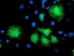 KATNB1 Monoclonal Antibody (OTI5A10), TrueMAB , OriGene:Antibodies:Primary