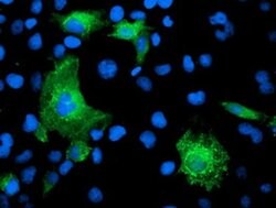 KATNB1 Monoclonal Antibody (OTI5F9), TrueMAB , OriGene:Antibodies:Primary