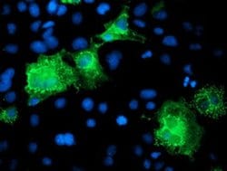 KATNB1 Monoclonal Antibody (OTI5E1), TrueMAB , OriGene 30 &mu;L; Unconjugated:Antibodies,