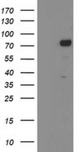 KATNB1 Monoclonal Antibody (OTI5A1), TrueMAB , OriGene 30 &mu;L; Unconjugated:Antibodies,