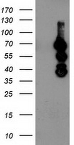 KATNB1 Monoclonal Antibody (OTI1A3), TrueMAB , OriGene:Antibodies:Primary