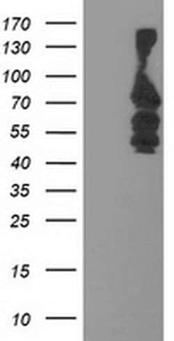 KATNB1 Monoclonal Antibody (OTI3B6), TrueMAB , OriGene:Antibodies:Primary