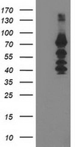 KATNB1 Monoclonal Antibody (OTI5A10), TrueMAB , OriGene 100 &mu;L; Unconjugated:Antibodies,