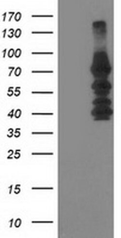 KATNB1 Monoclonal Antibody (OTI5F9), TrueMAB , OriGene 100 &mu;L; Unconjugated:Antibodies,