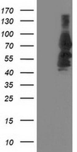 KATNB1 Monoclonal Antibody (OTI5E1), TrueMAB , OriGene 30 &mu;L; Unconjugated:Antibodies,
