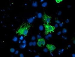KCNAB1 Monoclonal Antibody (OTI2F1), TrueMAB , OriGene:Antibodies:Primary