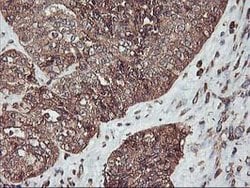 KCNAB1 Mouse anti-Human, Clone: OTI4E7, lyophilized, TrueMAB 100 &mu;g;