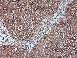 KCNAB1 Mouse anti-Human, Clone: OTI4E7, lyophilized, TrueMAB 100 &mu;g;