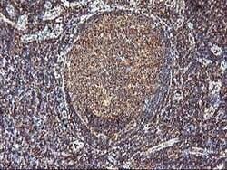 KCNAB1 Mouse anti-Human, Clone: OTI4E7, lyophilized, TrueMAB 100 &mu;g;