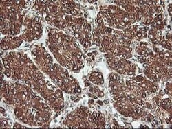 KCNAB1 Mouse anti-Human, Clone: OTI4E7, lyophilized, TrueMAB 100 &mu;g;