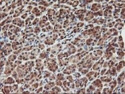 KCNAB1 Monoclonal Antibody (OTI7C7), TrueMAB , OriGene 30 &mu;L; Unconjugated:Antibodies,