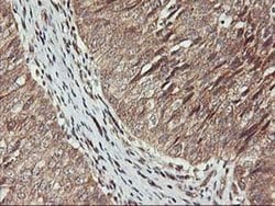 KCNAB1 Monoclonal Antibody (OTI7C7), TrueMAB , OriGene 30 &mu;L; Unconjugated:Antibodies,