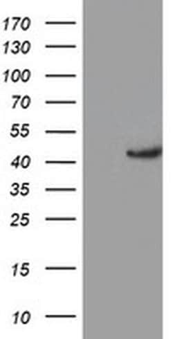 KCNAB1 Monoclonal Antibody (OTI1C2), TrueMAB , OriGene 100 &mu;L; Unconjugated:Antibodies,