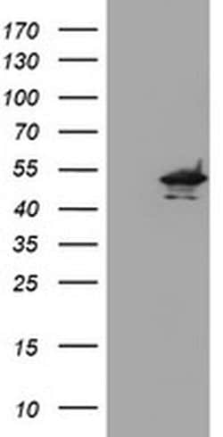 KCNAB1 Monoclonal Antibody (OTI2A8), TrueMAB , OriGene:Antibodies:Primary