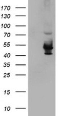 KCNAB1 Mouse anti-Human, Clone: OTI4E7, lyophilized, TrueMAB 100 &mu;g;