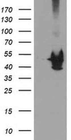 KCNAB1 Monoclonal Antibody (OTI7C7), TrueMAB , OriGene 30 &mu;L; Unconjugated:Antibodies,