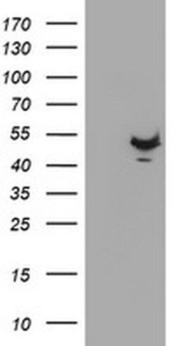 KCNAB1 Monoclonal Antibody (OTI6E5), TrueMAB , OriGene:Antibodies:Primary