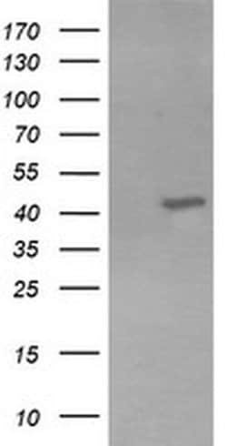 KCNAB1 Monoclonal Antibody (OTI2F1), TrueMAB , OriGene 30 &mu;L; Unconjugated:Antibodies,