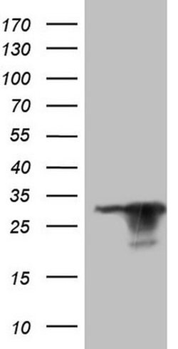 KCNIP2 Monoclonal Antibody (OTI14A7), TrueMAB , OriGene 100 &mu;L; Unconjugated:Antibodies,